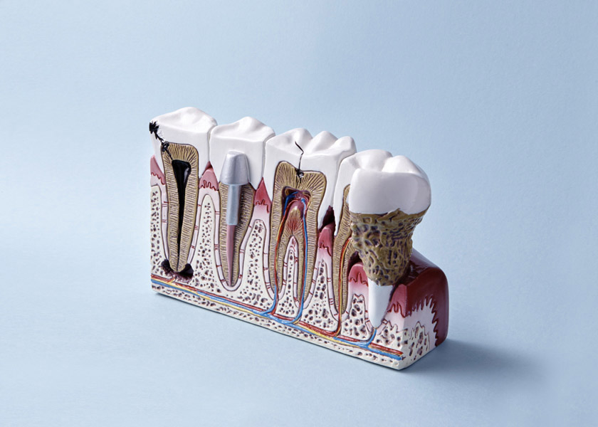 Endodonzia - Studio Dentistico Perin Michele